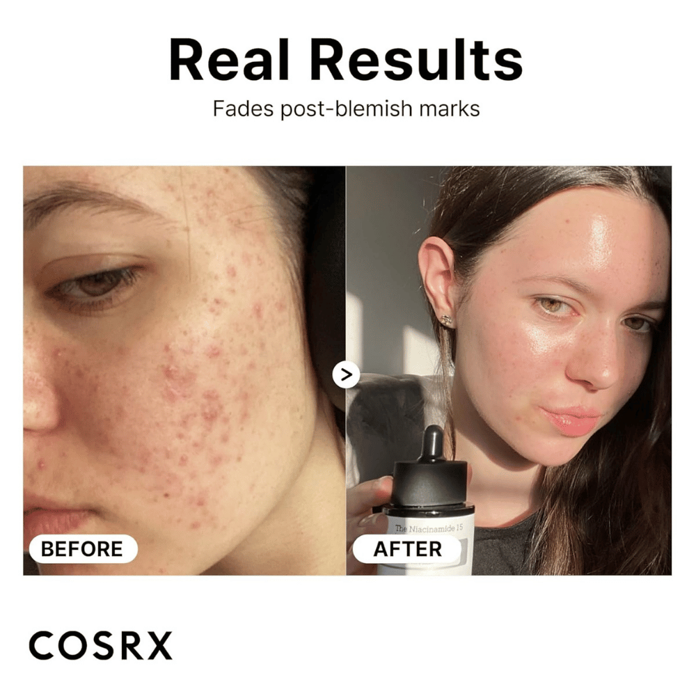 COSRX Niacinamide 15% Face Serum