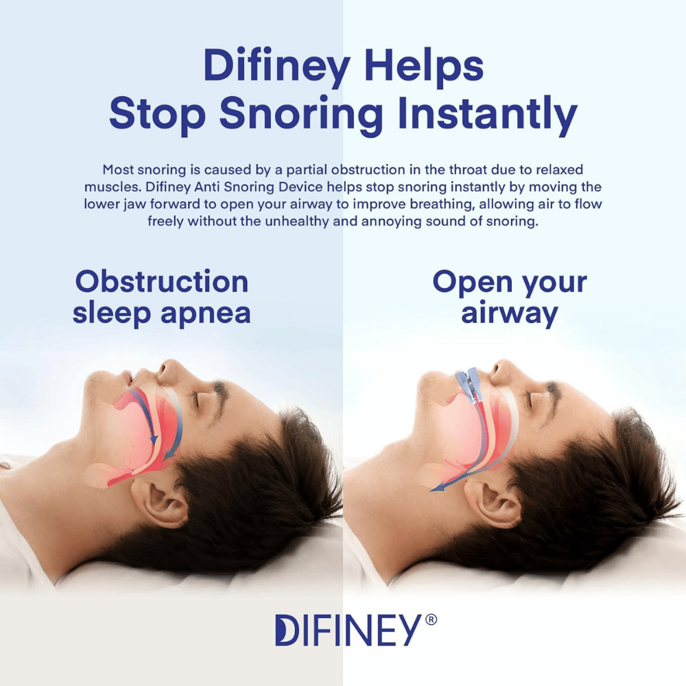 Difiney Mouth Guard For Snoring